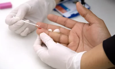 La Provincia cubrirá análisis para personas con VIH