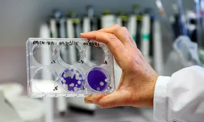 El virus H3N2 de la gripe ya circula en Argentina