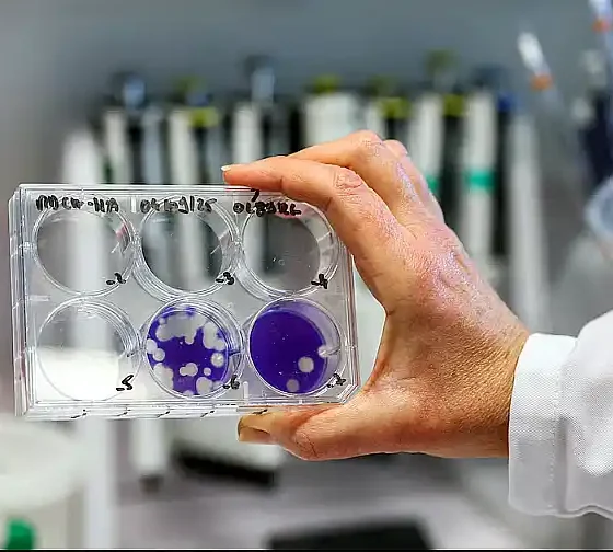 El virus H3N2 de la gripe ya circula en Argentina