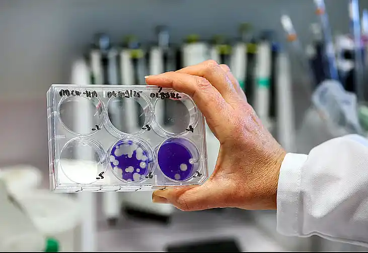 El virus H3N2 de la gripe ya circula en Argentina