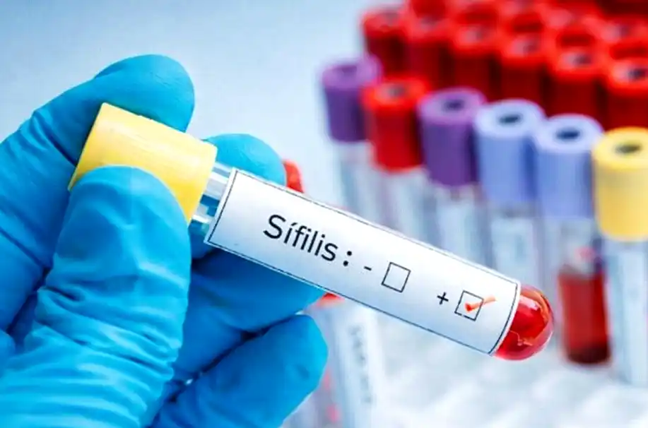 sifilis alerta