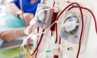 Más de 30.000 argentinos dependen de diálisis
